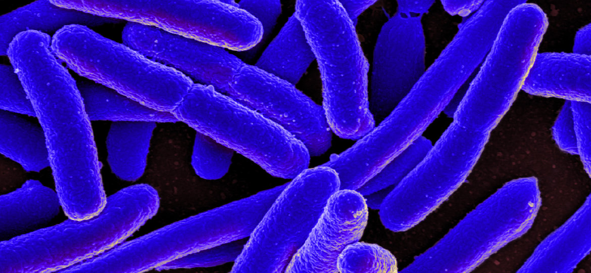 Scanning electron micrograph of Escherichia coli